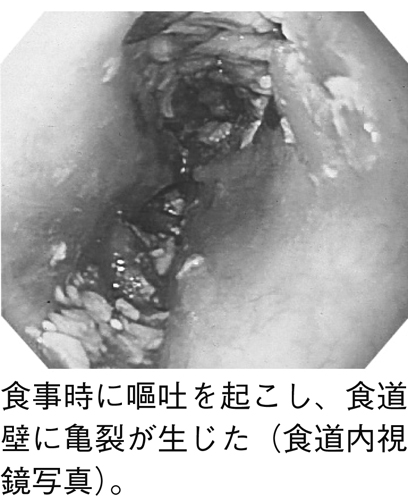 病気事典の図表