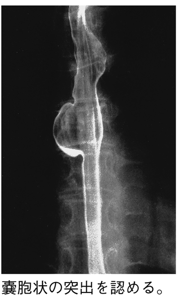 病気事典の図表