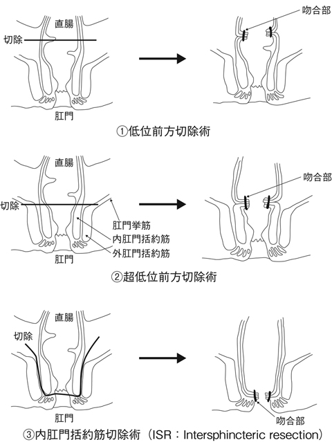 病気事典の図表