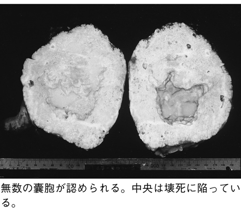 病気事典の図表