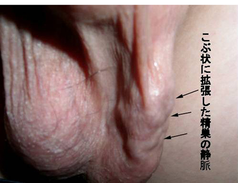 病気事典の図表