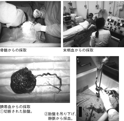 病気事典の図表