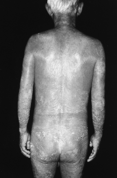 病気事典の図表