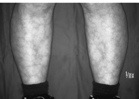 病気事典の図表