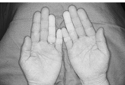 病気事典の図表