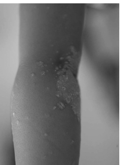 病気事典の図表