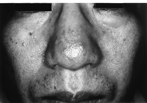 病気事典の図表