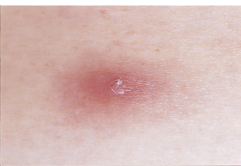 病気事典の図表