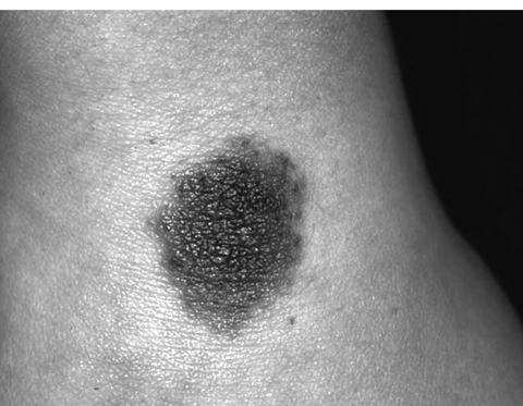 病気事典の図表