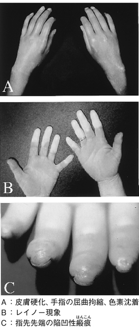 病気事典の図表