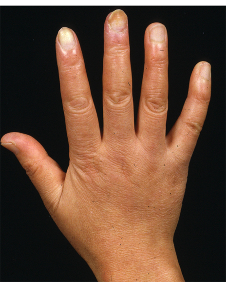 病気事典の図表