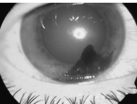 病気事典の図表