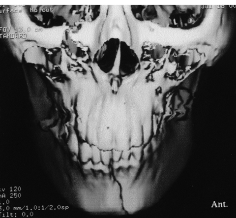 病気事典の図表