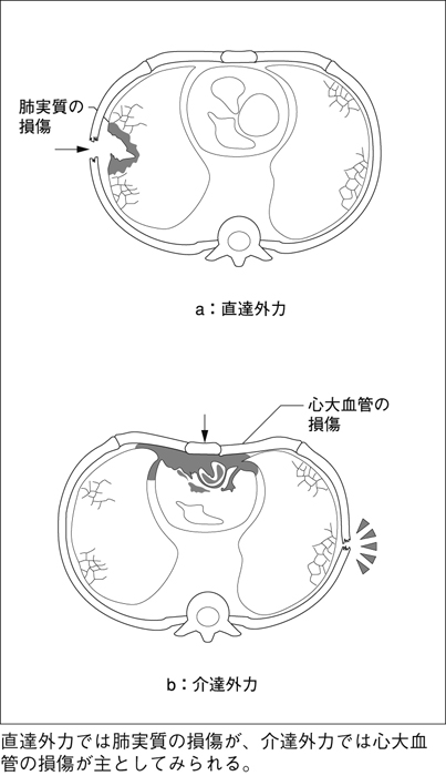 病気事典の図表