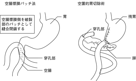 病気事典の図表