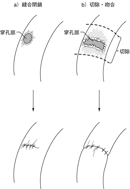 病気事典の図表