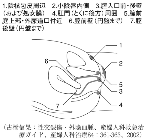 病気事典の図表