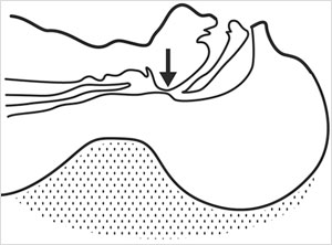 病気事典の図表